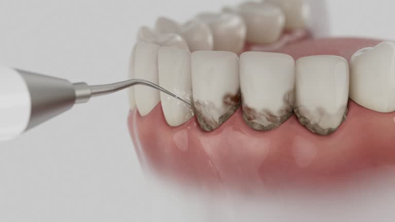 Trusted Tooth Extraction service in Hico, TX - Dentist Open Now